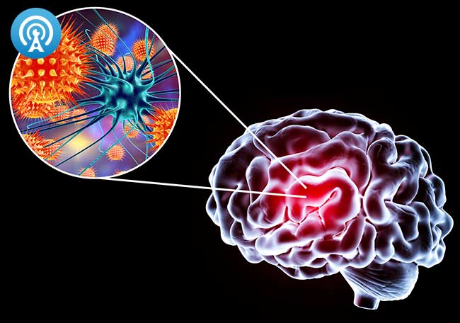 Encefalitis: Cuáles Son Las Causas Y Con Qué Enfermedades Puede Ser ...